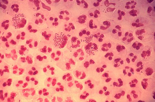 Бактериофаги – «пожиратели» бактерий