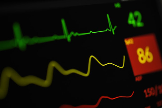 Нарушение сердечного ритма: симптомы, причины, диагностика, виды и методы лечения в «СМ-Клиника»
