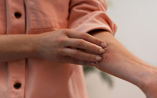 Краснуха - симптомы, признаки, виды и лечение вируса краснухи у взрослых в Москве в «СМ-Клиника»